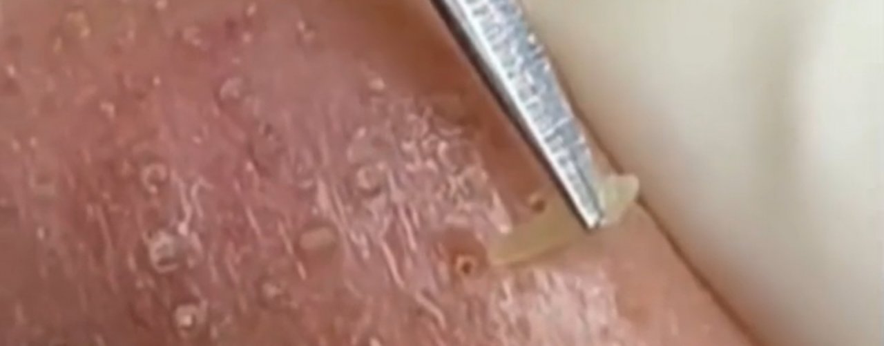 Релакс Смех