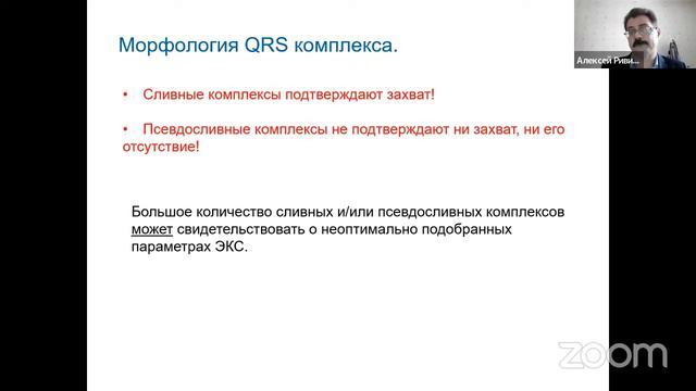 Интерпретация ЭКГ у пациентов со стимуляторами. Особенности формирования и содержания заключения ХМ