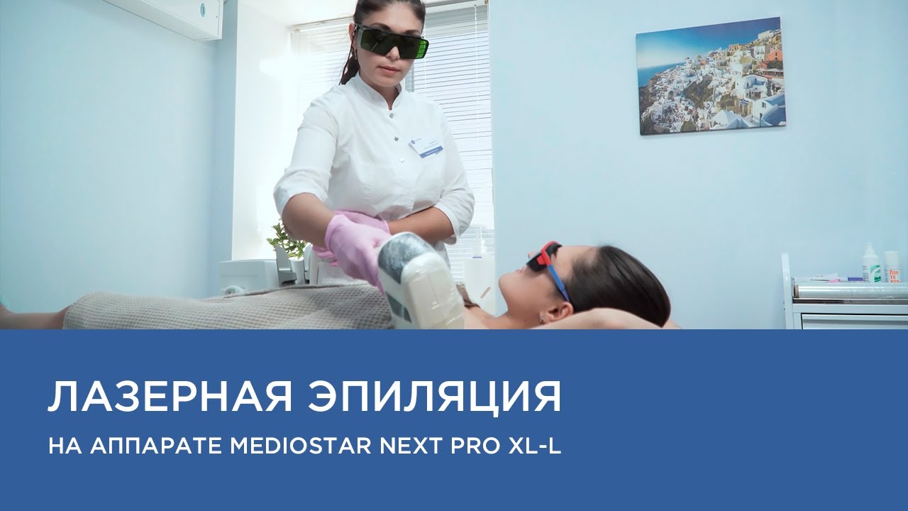 Лазерная эпиляция на аппарате Asclepion MeDioStar NeXT PRO XL-L