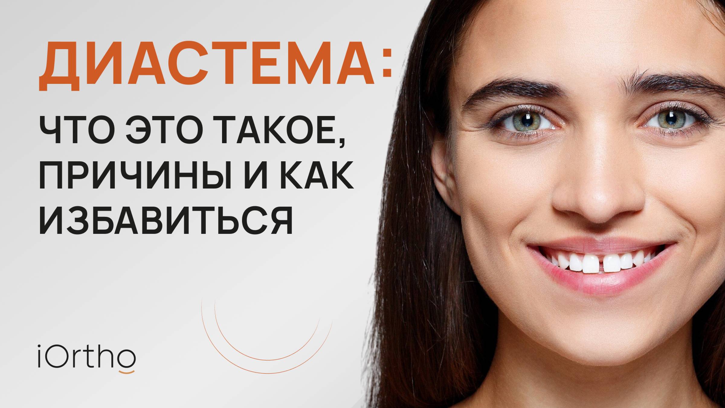 🤔 Диастема: что это такое, причины и как избавиться