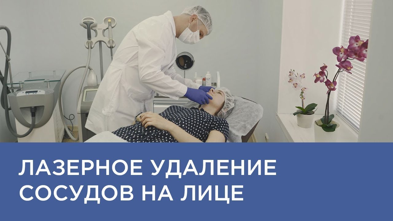 Удаление сосудов на лице на лазере Cutera XEO в Астрахани