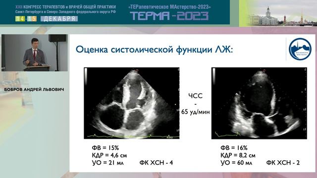Эхокардиографическая оценка анатомии и функции сердца в различных клинических рекомендациях