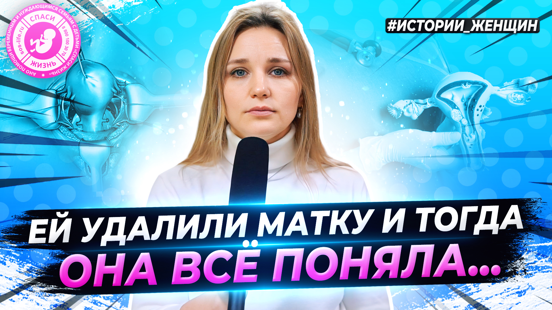 ● НЕ ХОТЕЛA РОЖAТЬ, НО ПОСЛЕ ОПЕРAЦИИ ОНA ВСЁ ПОНЯЛA! #ИСТОРИИ_ЖЕНЩИН