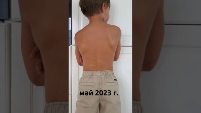 ИМПЕТИГО: история исцеления от страха