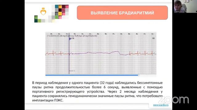 Современные устройства для длительного телемониторирования ЭКГ: преимущества и недостатки