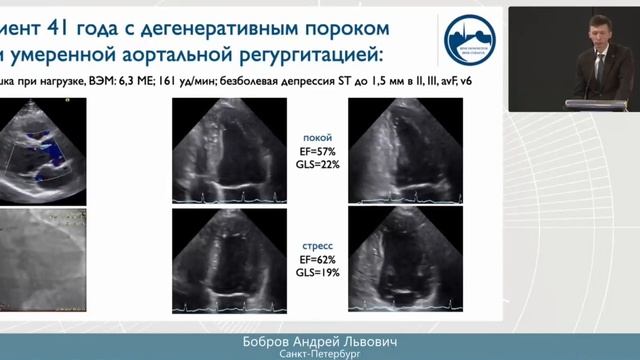 Роль стресс-эхо в определении тяжести клапанной недостаточности и показаний к оперативному лечению