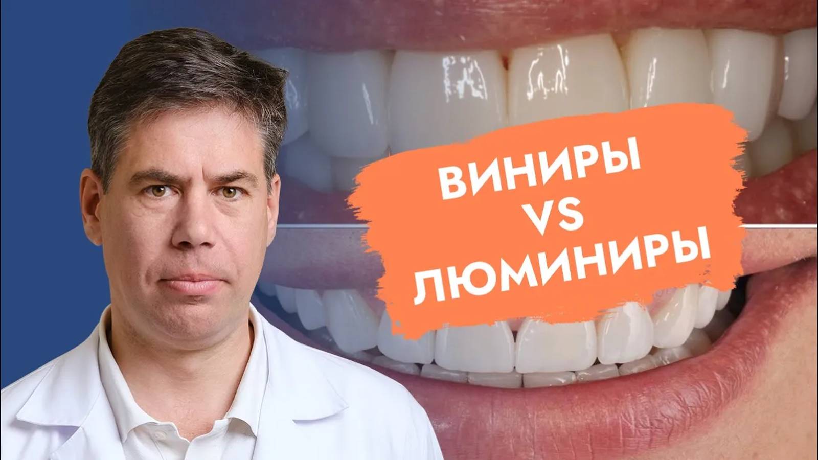 Когда можно делать виниры?