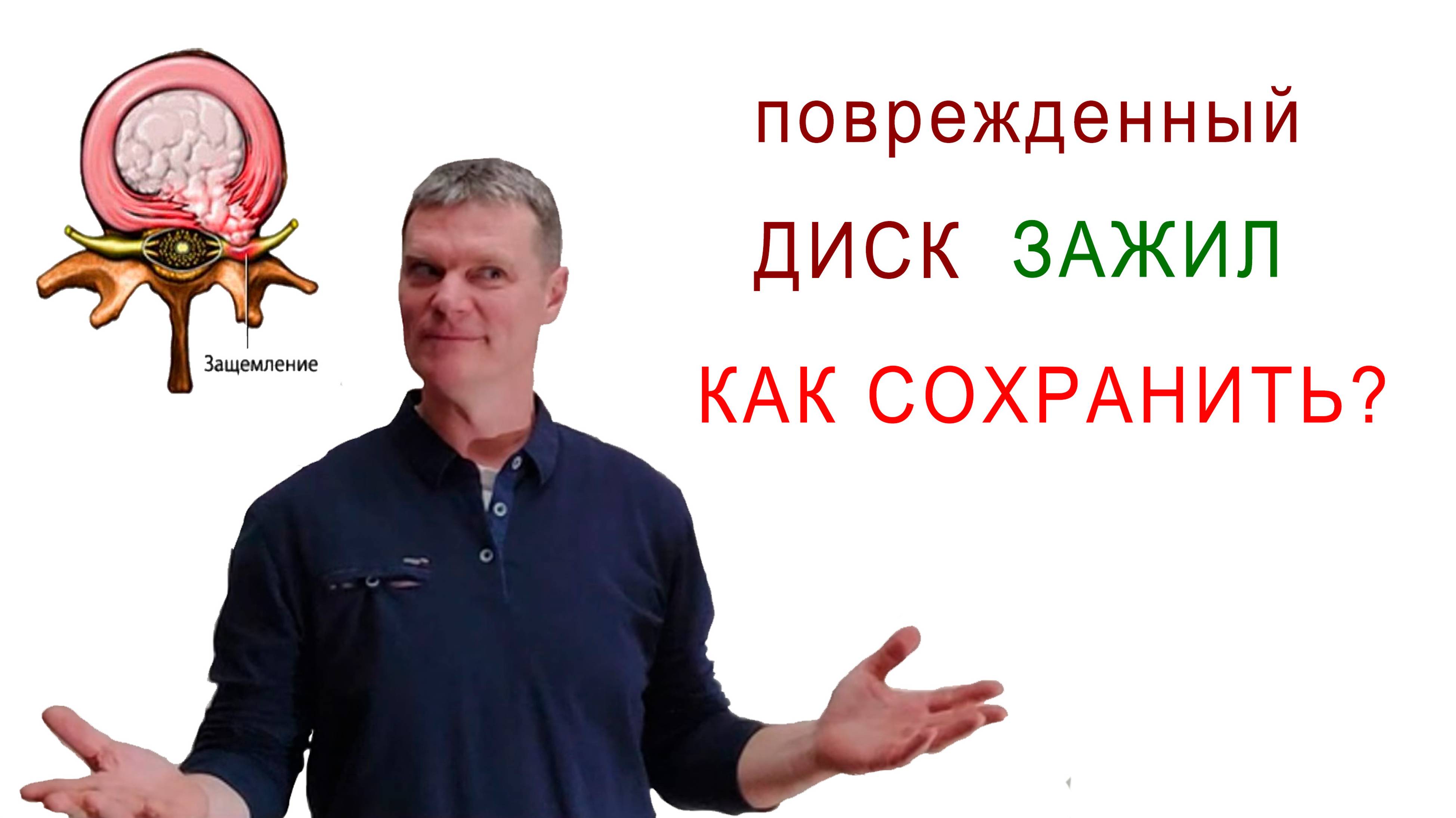 Профилактика травмы межпозвонкового диска