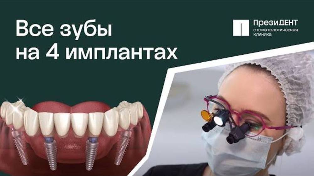 👉🏻 Имплантация зубов All on 4 (все на 4): ответы на все вопросы в этом видео.