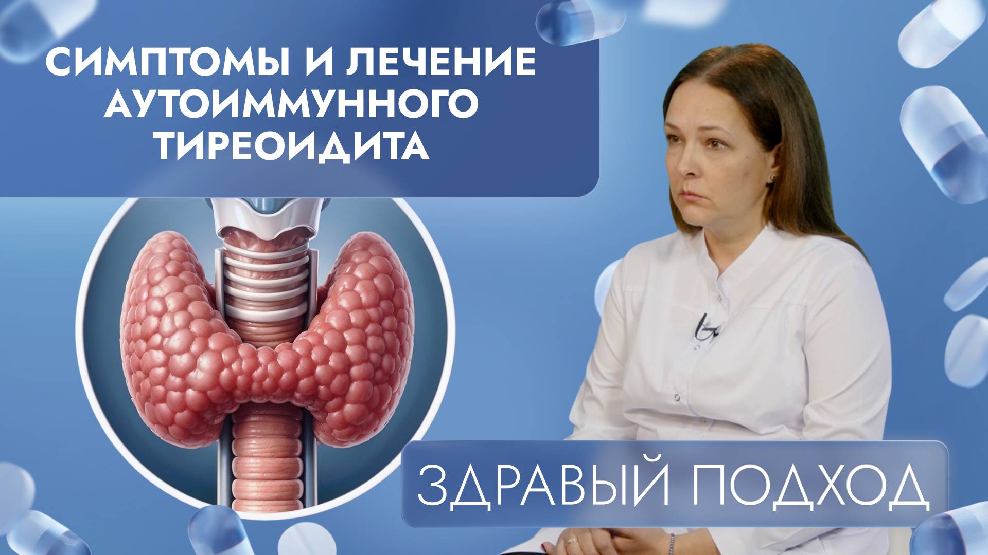 Симптомы и лечение аутоиммунного тиреоидита | Здравый подход (2024)