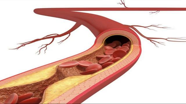 АТЕРОСКЛЕРОЗ (Оздоровление сердца и Сосудов)*Квантовое исцеление звуком