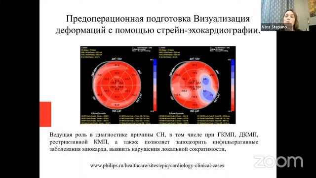 Особенности имплантации СРТ: необходимость предоперационной подготовки