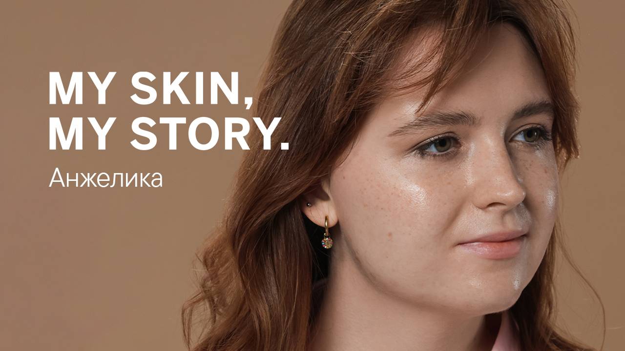 MY SKIN, MY STORY. – Анжелика