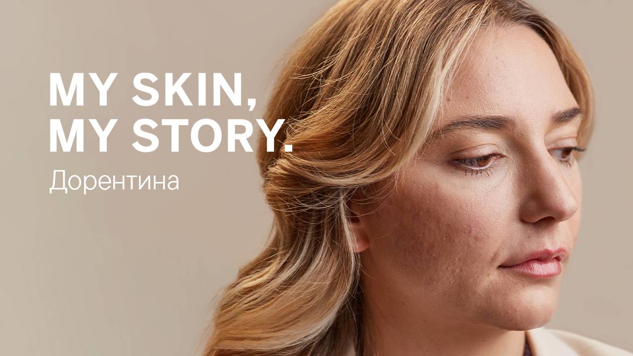MY SKIN, MY STORY. – Дорентина