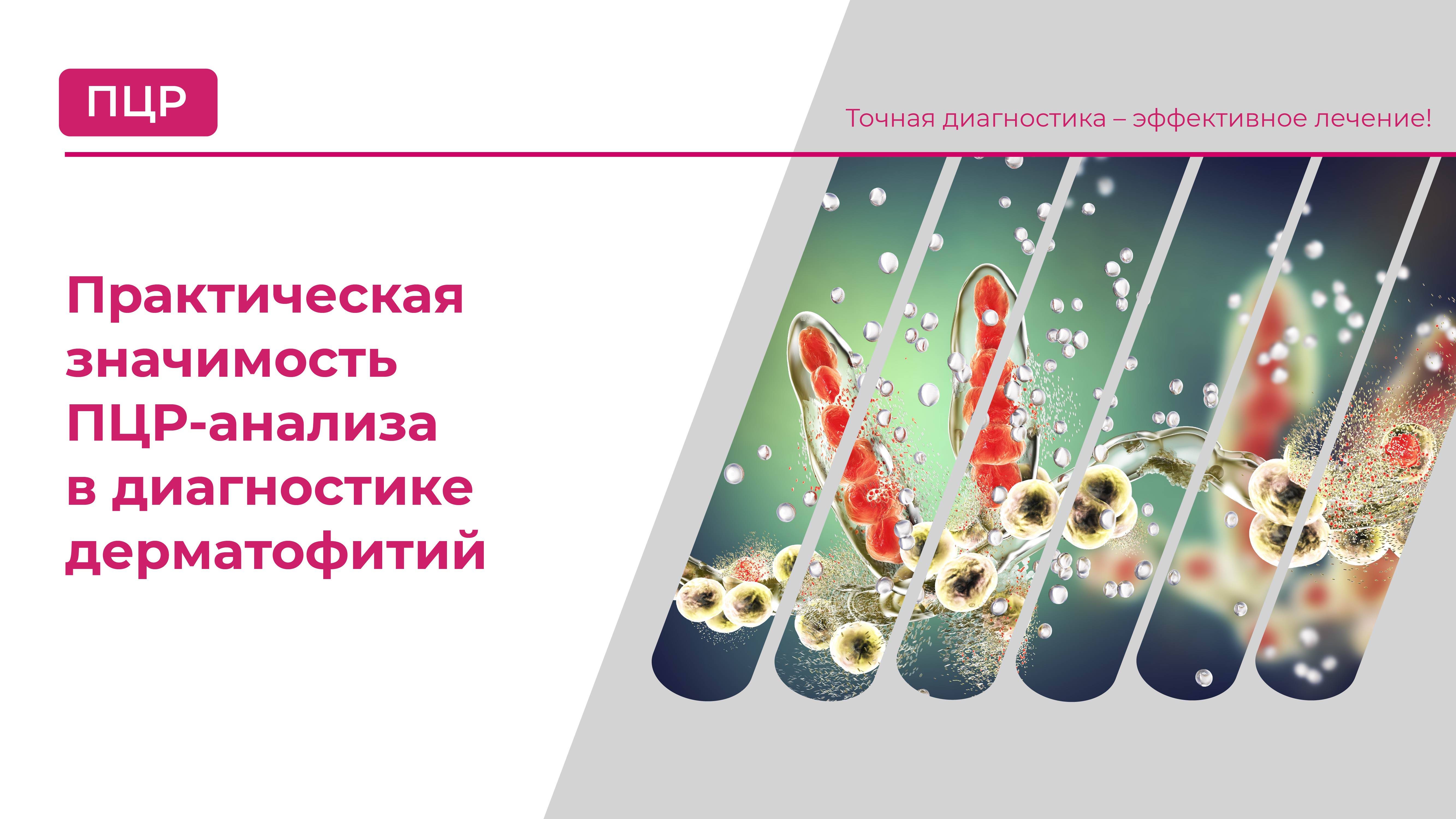 Практическая значимость ПЦР-анализа в диагностике дерматофитий