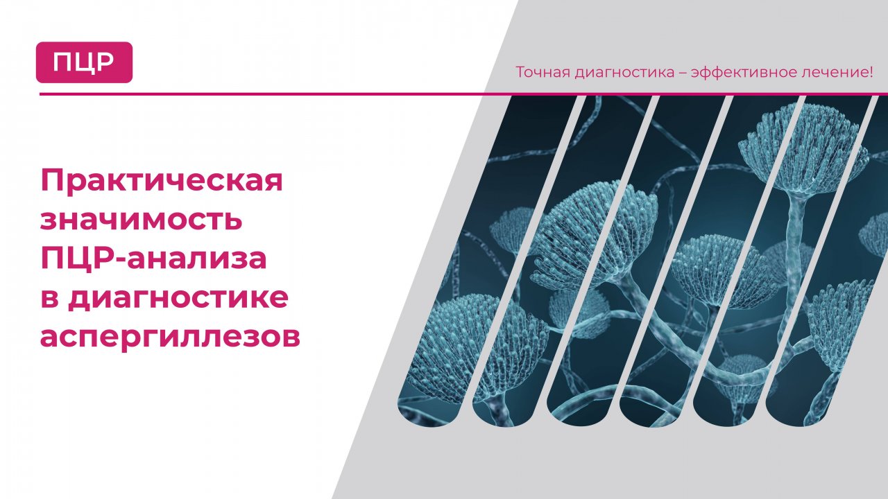 Практическая значимость ПЦР-анализа в диагностике аспергиллезов