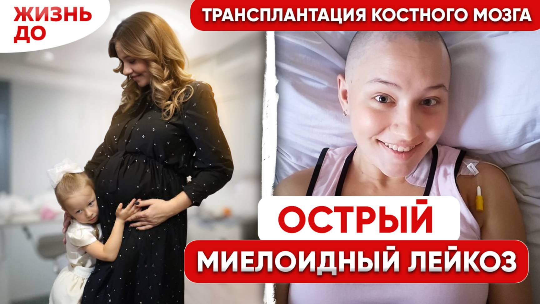 Думала, что это анемия, а оказалась лейкоз во время беременности. Моя история борьбы с раком крови