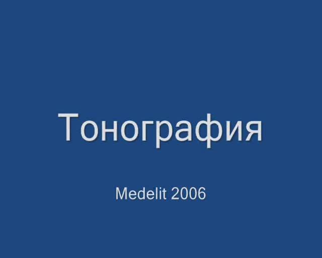 Тонография