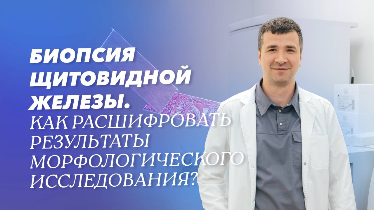 Биопсия щитовидной железы: результаты морфологического исследования