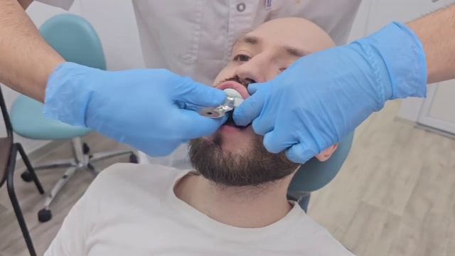 Слепок с пленкой 2