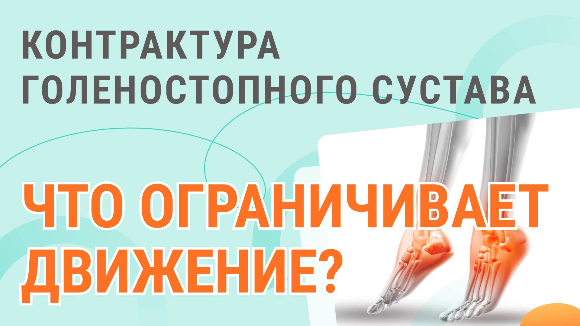 🧐🦶 Контрактура голеностопного сустава, что ограничивает движение?