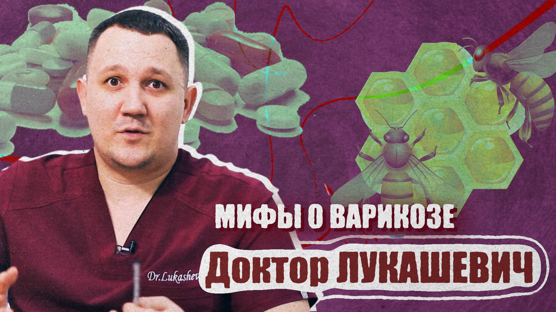 Мифы о варикозе. Доктор Лукашевич