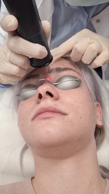 Шлифовка шрама