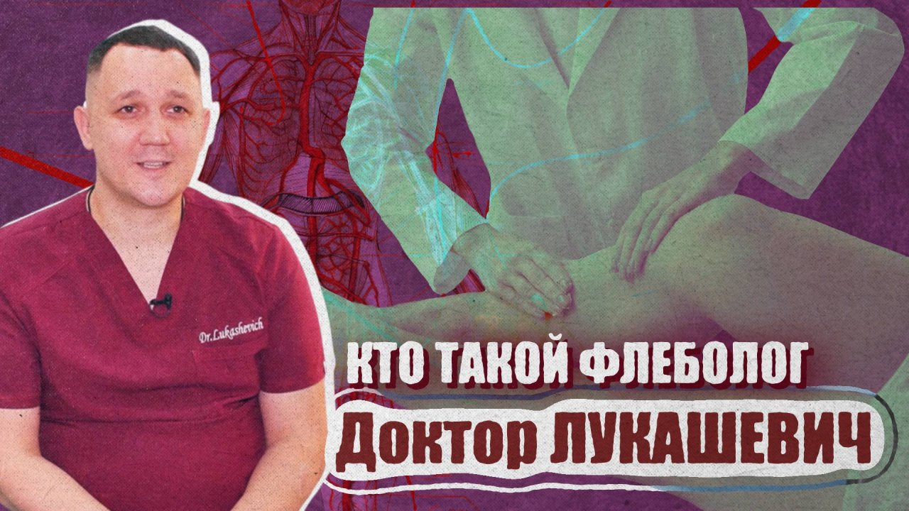 Кто такой флеболог? Доктор Лукашевич