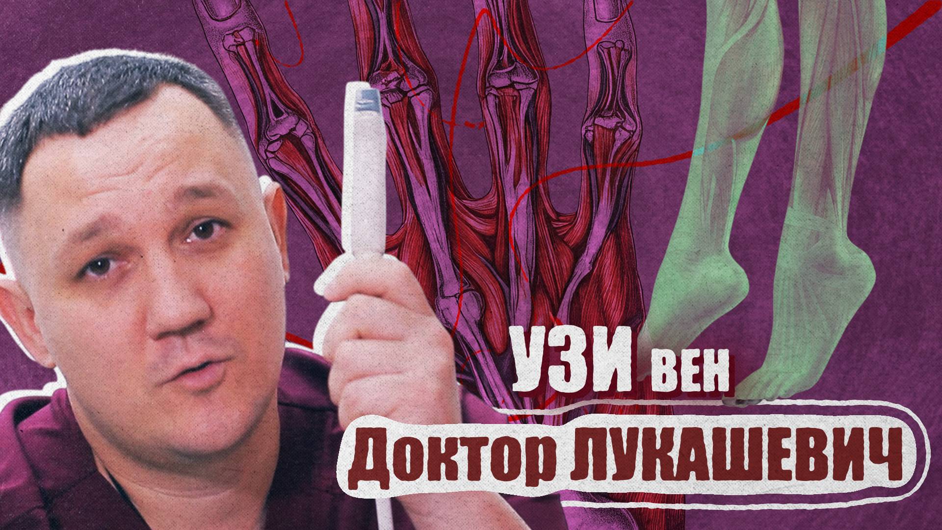 Как проводится УЗИ вен? Доктор Лукашевич