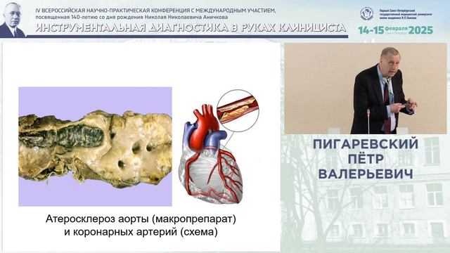В память об открытии патогенеза атеросклероза (к 140-летию со дня рождения Н.Н. Аничкова)