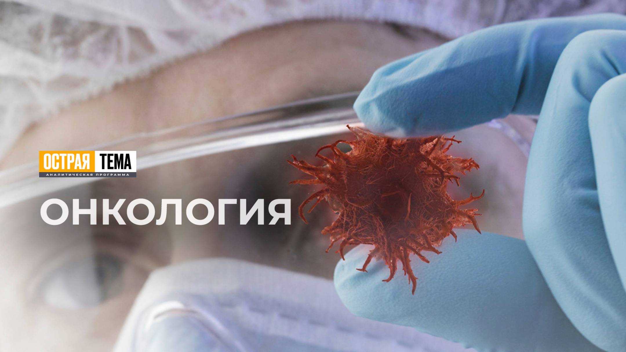 Онкология: причины ее возникновения и группы риска. "Острая тема"