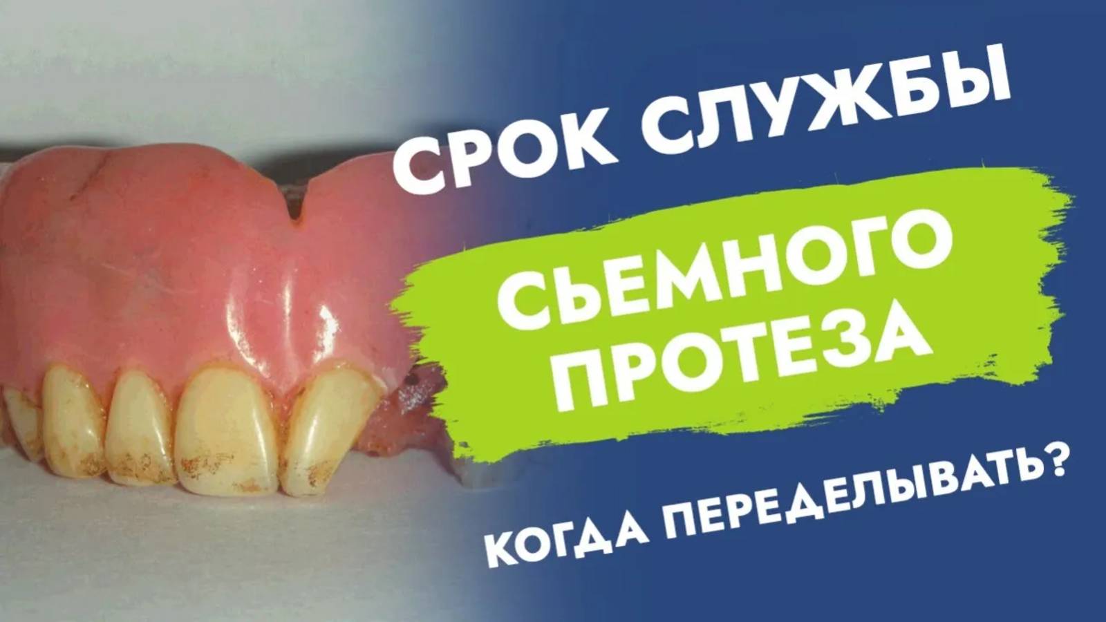 Через какое время надо переделывать съемный протез?