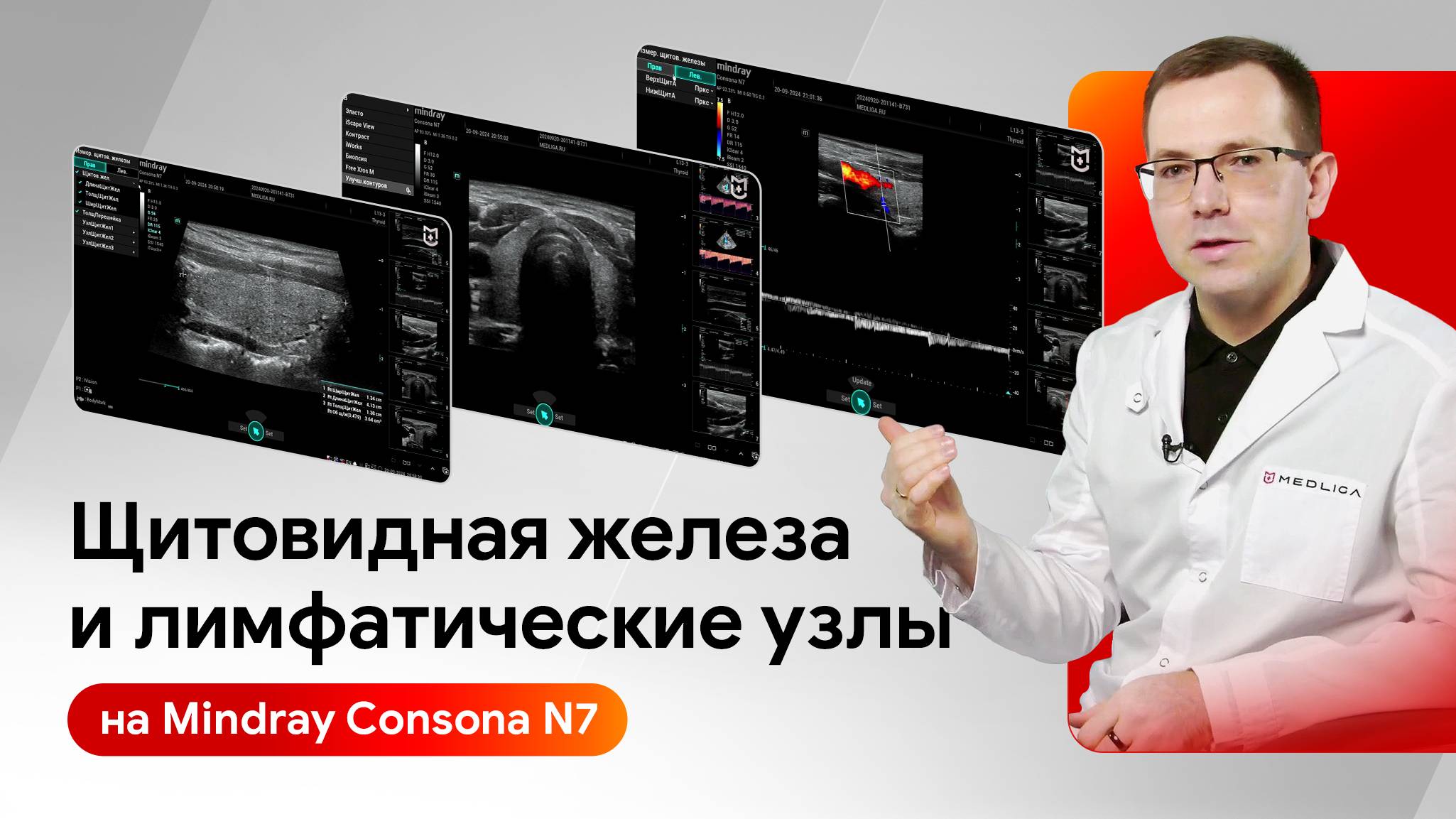 УЗИ щитовидной железы и лимфатических узлов на Mindray Consona N7