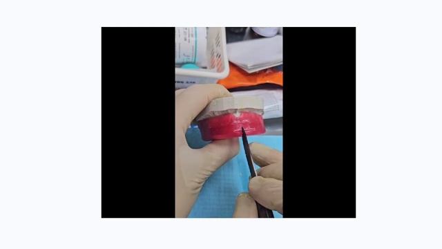 Определение прикуса