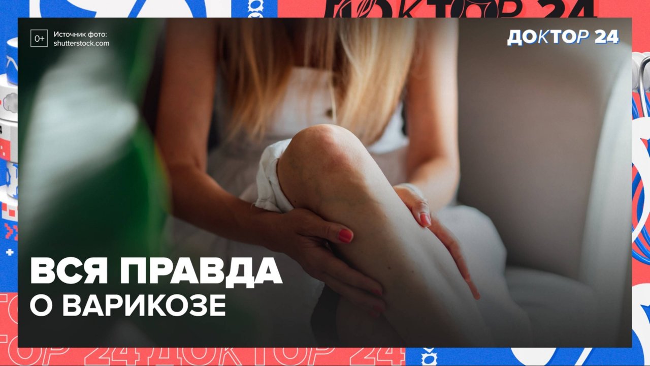 Что нужно знать о ВАРИКОЗЕ? ТЕМЫ НЕДЕЛИ | Доктор 24