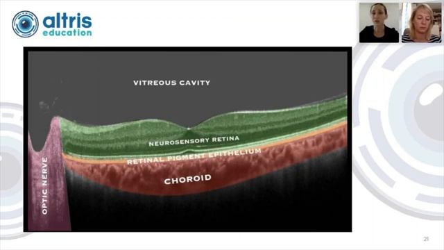 Вебинар Основы ОКТ_ Основные термины, понятия и современная номенклатура ОКТ