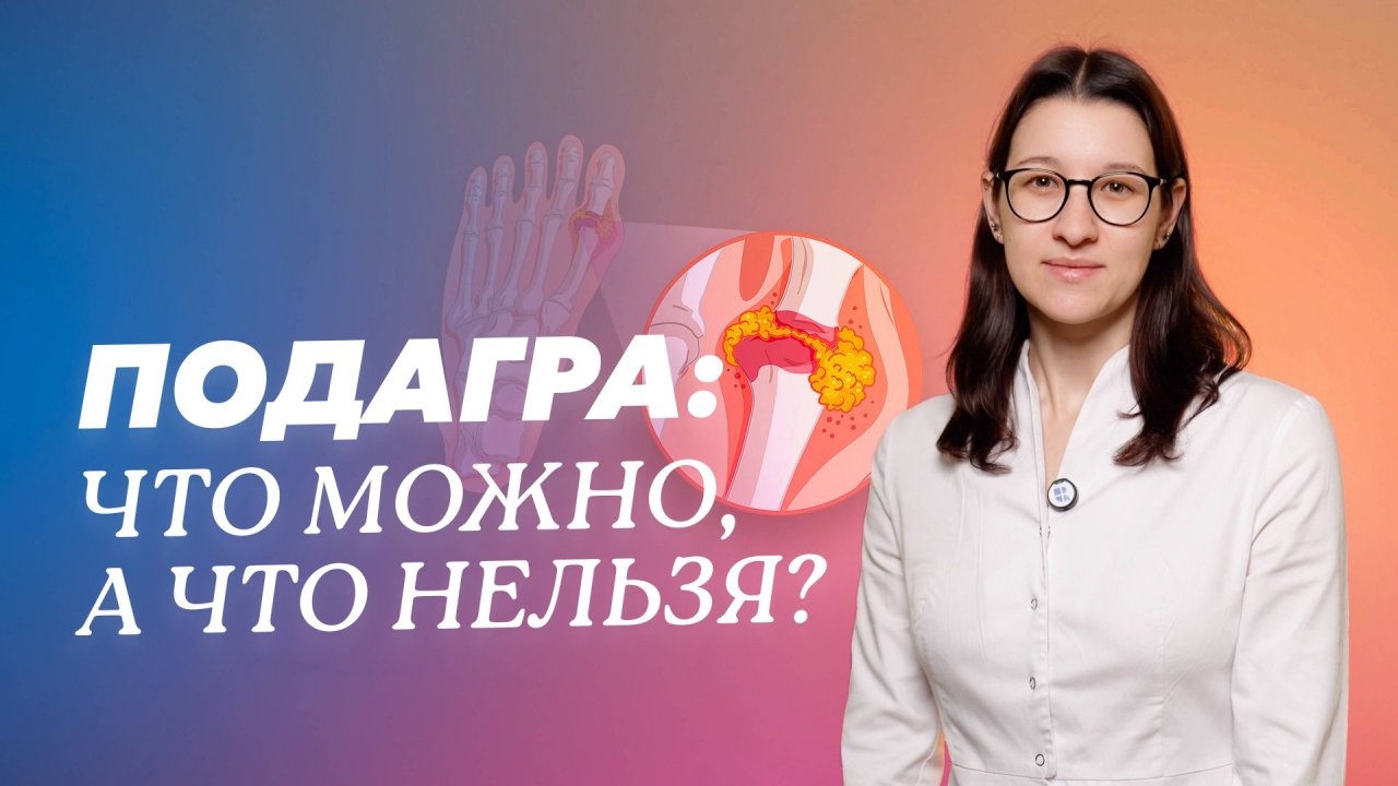 Подагра: скрытая угроза для ваших суставов!