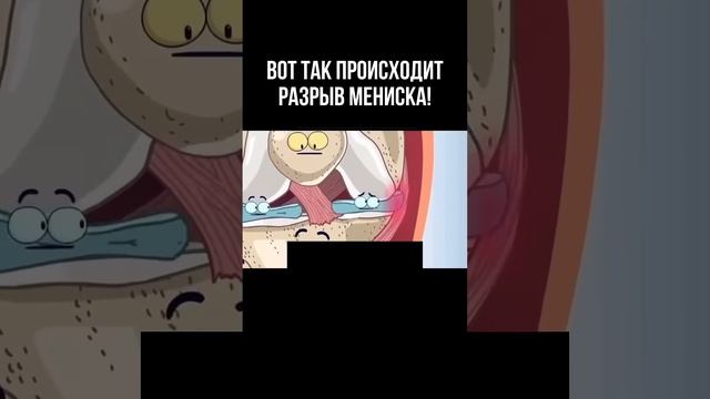 Травма колена озвучил врач Георгий Темичев #реабилитация #спортивнаямедицина #спорт #мениск #травма