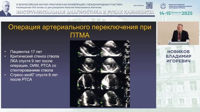 Транспозиция магистральных артерий у взрослых пациентов