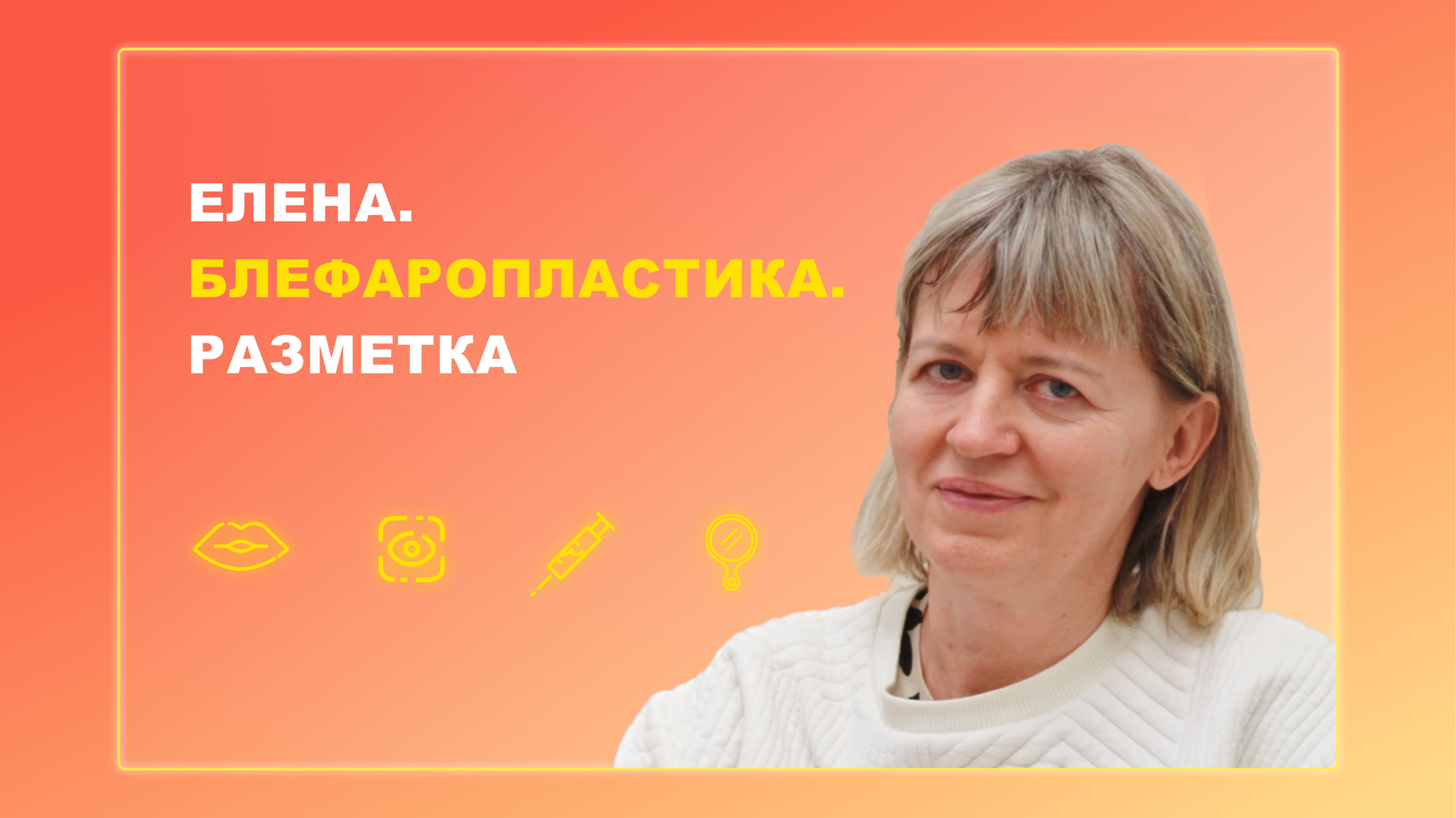 Елена. Блефаропластика. Разметка.