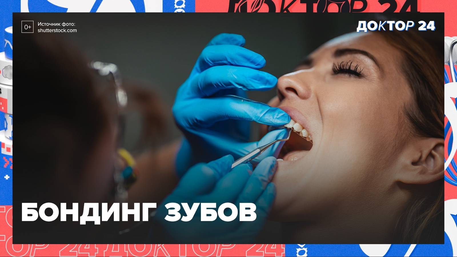 БОНДИНГ ЗУБОВ | Доктор 24