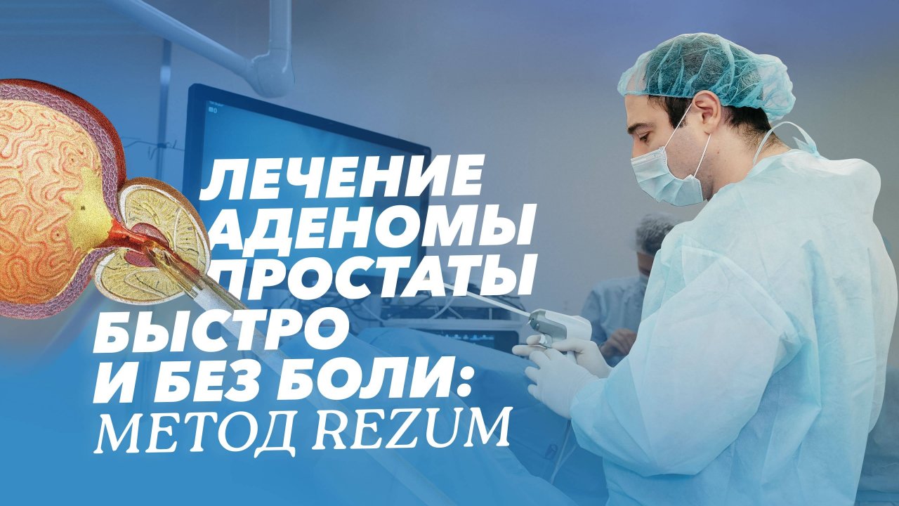 Инновационный метод Rezum: попрощайтесь с симптомами аденомы простаты