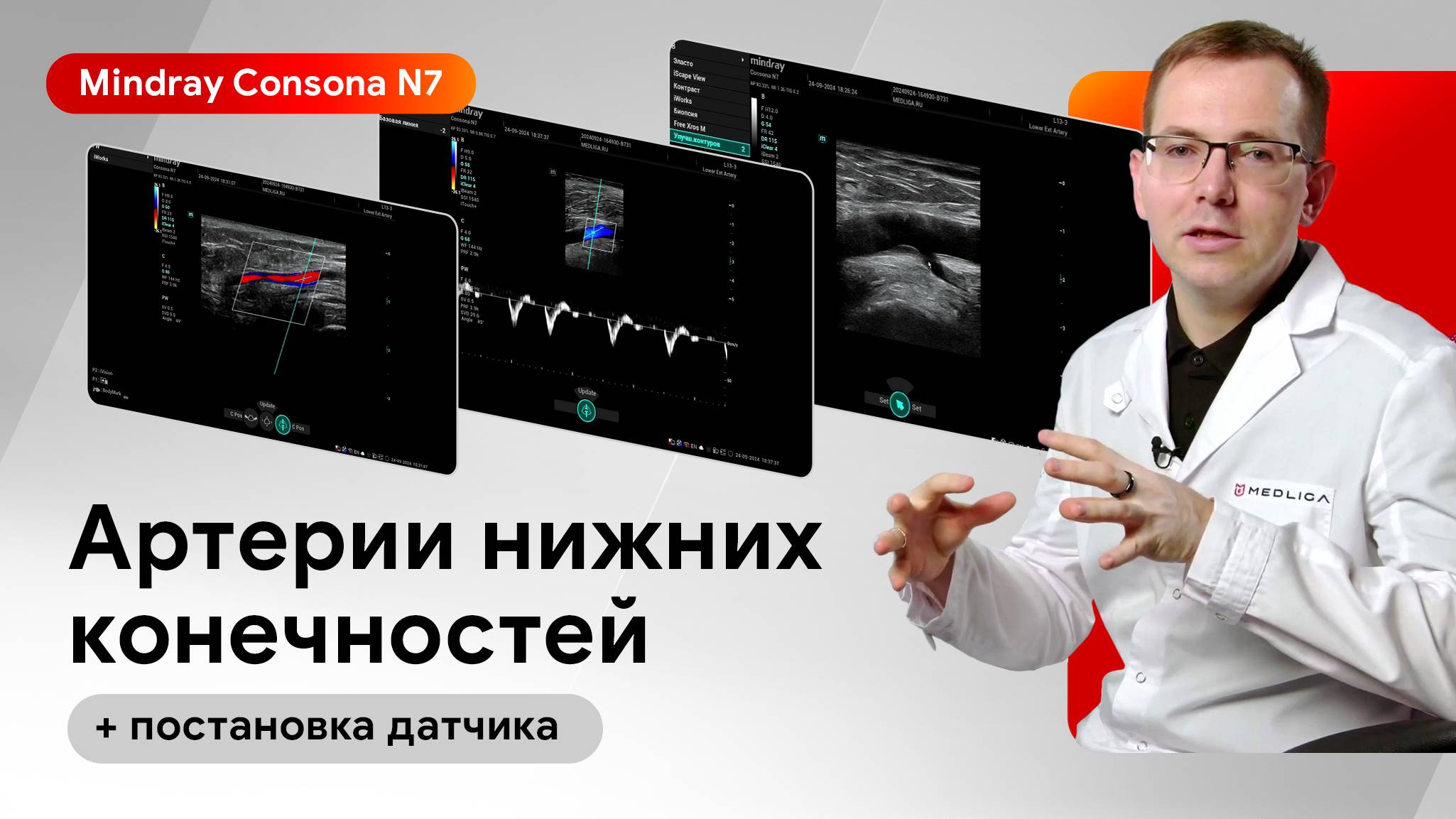 УЗИ артерий нижних конечностей и постановка датчика на Mindray Consona N7