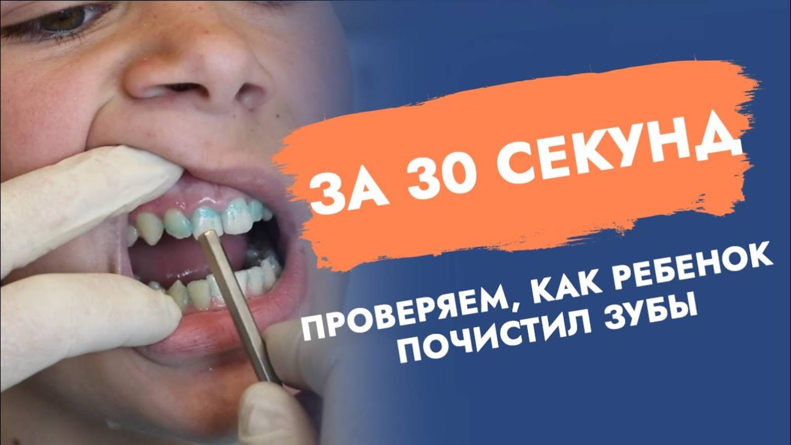 Чистит или не чистит зубы? Контролируем ребенка!