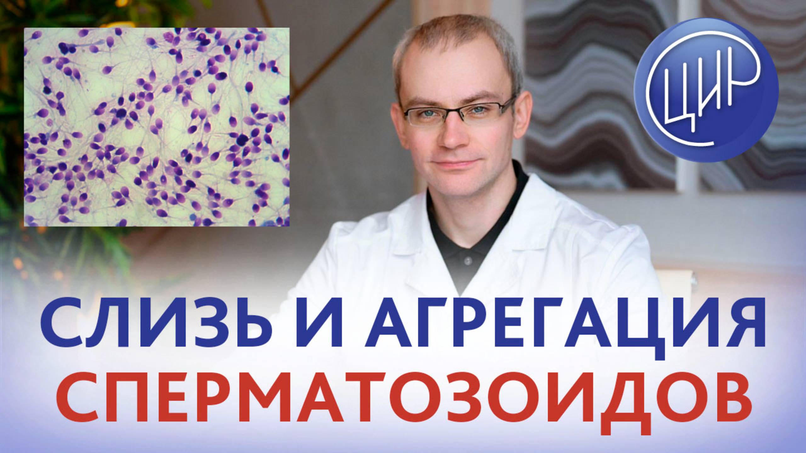 Слизь и агрегация сперматозоидов - что это значит? Спермограмма. Расшифровка спермограммы.