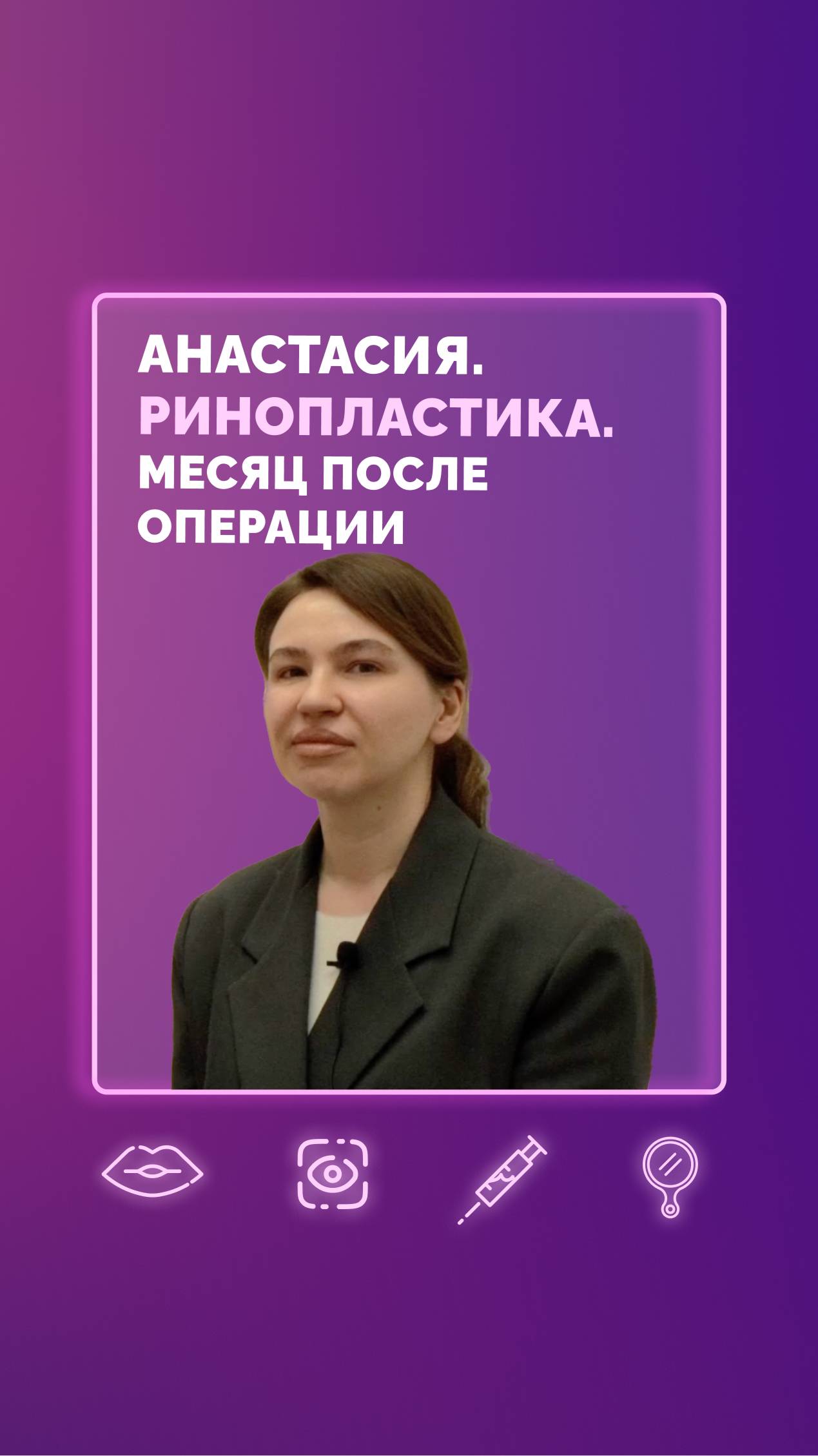 Анастасия. Ринопластика. Месяц после операции