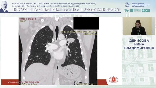 Функциональная оценка операбельности у пациентов с туберкулёзом лёгких...