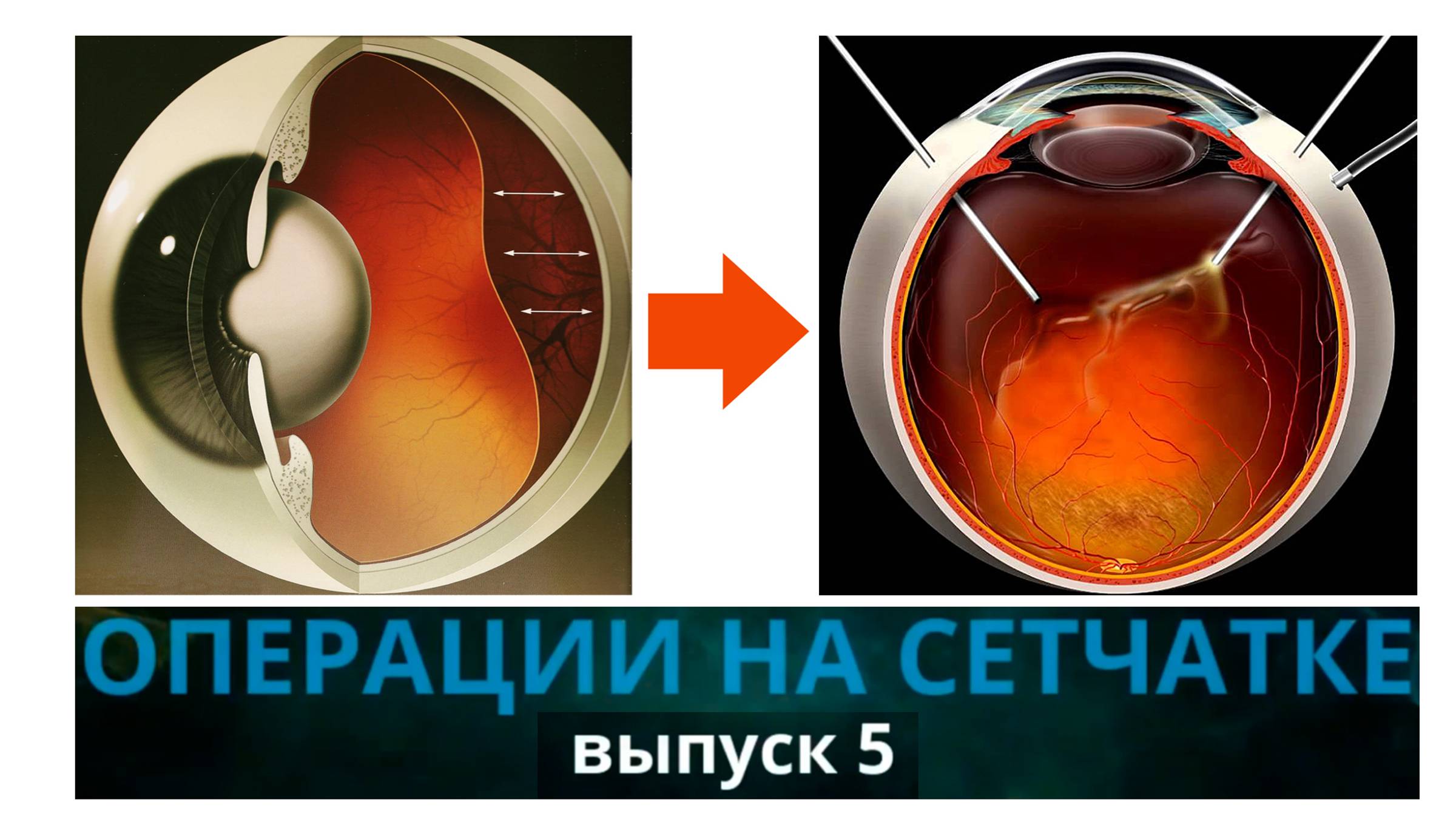 Другая офтальмология. Выпуск 5. Операции на сетчатке у животных