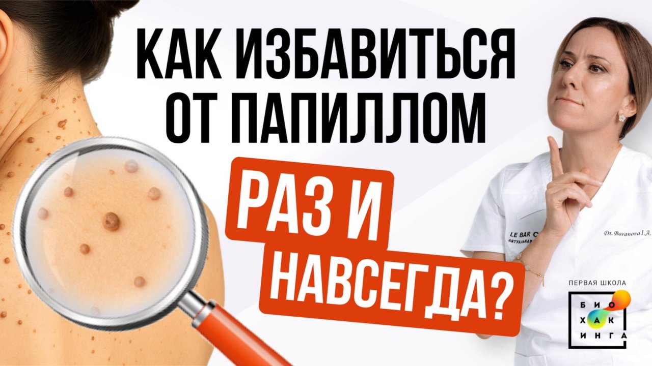 Почему появляются папилломы? Как остановить их рост? #сахар #пшб #иринабаранова