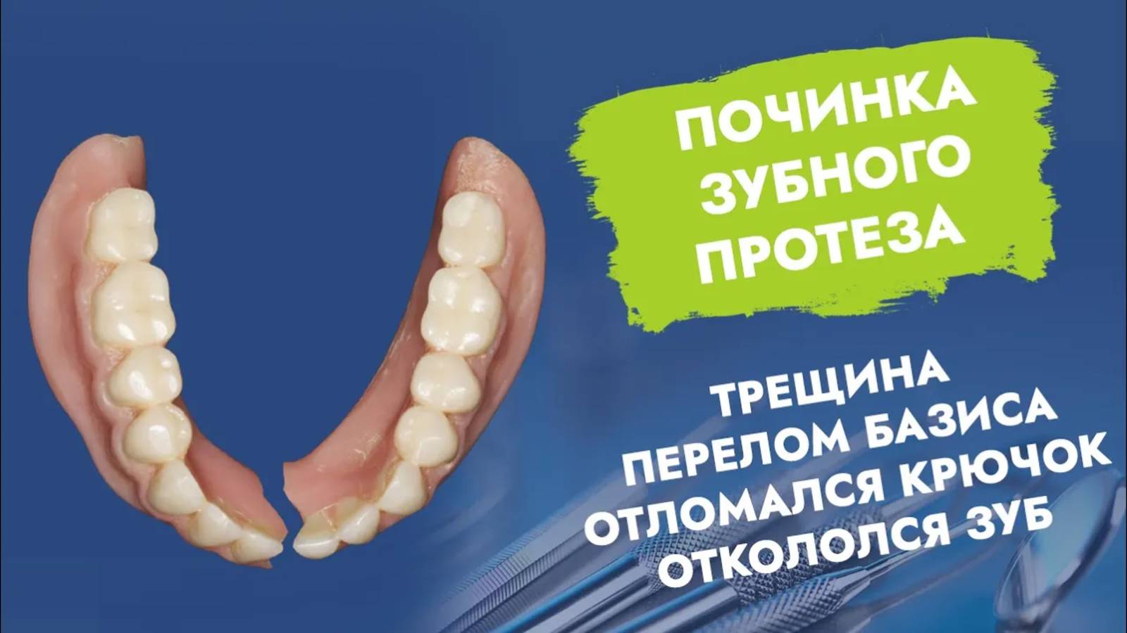 Что делать со сломавшимся съемным протезом?